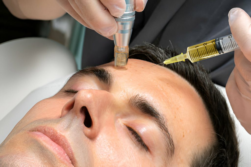 Radiance therapy prp islamabad